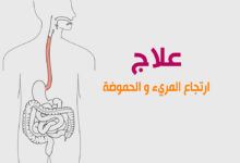 ارتجاع المريء و الحموضة