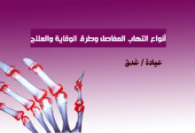التهاب المفاصل