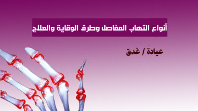 التهاب المفاصل Arthritis 1 التهاب المفاصل