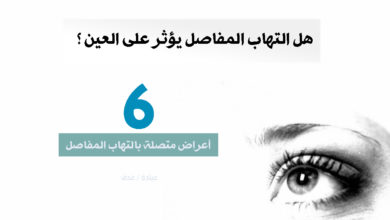 تأثير التهاب المفاصل على العينين 46 هل التهاب المفاصل يؤثر على العينين ؟