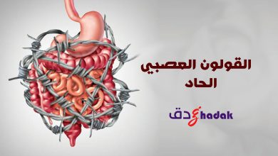 القولون العصبي الحاد 21 القولون العصبي الحاد
