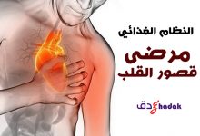 النظام الغذائي الخاص بمرضى قصور القلب