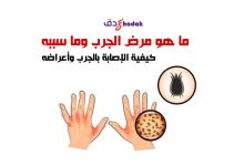ما هو مرض الجرب وما سببه
