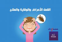 القمل الأعراض والوقاية والعلاج
