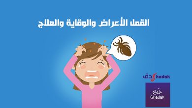 القمل الأعراض والوقاية والعلاج
