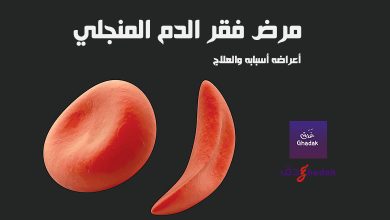 مرض فقر الدم المنجلي الأعراض والأسباب 44 مرض فقر الدم المنجلي