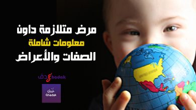 معلومات شاملة عن مرض متلازمة داون 11 معلومات شاملة عن مرض متلازمة داون
