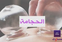 الحجامة وكيفية العلاج بها 84 الحجامة وكيفية العلاج بها
