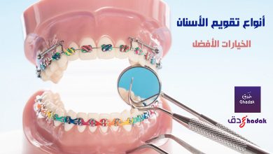 أنواع تقويم الأسنان المتوفرة والخيارات الأفضل 16 أنواع تقويم الأسنان المتوفرة والخيارات الأفضل