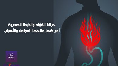 حرقة الفؤاد - الجزر المعدي المريئي 1 حرقة الفؤاد والذبحة الصدرية أعراضها علاجها العوامل والأسباب