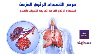 مرض الانسداد الرئوي المزمن 8 مرض الانسداد الرئوي المزمن