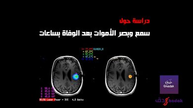 سمع وبصر الإنسان بعد الموت - حقائق 40 سمع وبصر الأموات بعد الوفاة بساعات