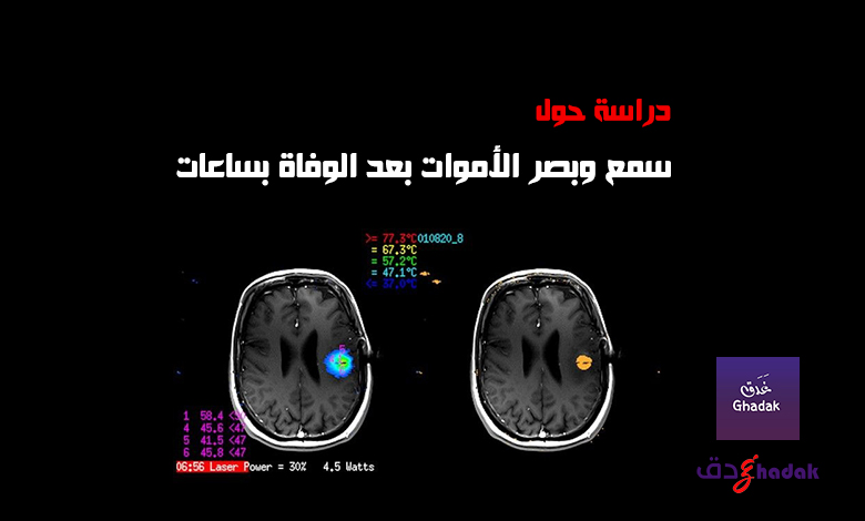 سمع وبصر الأموات بعد الوفاة بساعات