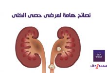 نصائح هامة لمرضى حصى الكلى