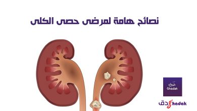 حصى الكلى ونصائح هامة جداً لتجنبها 41 نصائح هامة لمرضى حصى الكلى