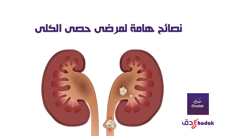 نصائح هامة لمرضى حصى الكلى