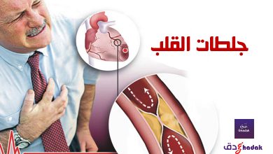 ماهي جلطات القلب وكيف نحم انفسنا منها 56 ماهي جلطات القلب