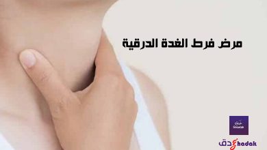 مرض فرط الغدة الدرقية Hyperthyroidism 41 مرض فرط الغدة الدرقية