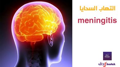 لماذا التهاب السحايا meningitis خطير جدا 32 لماذا التهاب السحايا meningitis خطير جدا