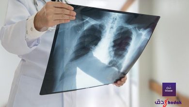 لماذا التهاب الرئة pneumonia خطير جداً 29 لماذا التهاب الرئة pneumonia خطير جداً