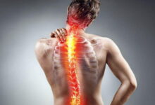  عرق النسا طريقة العلاج الفعالة